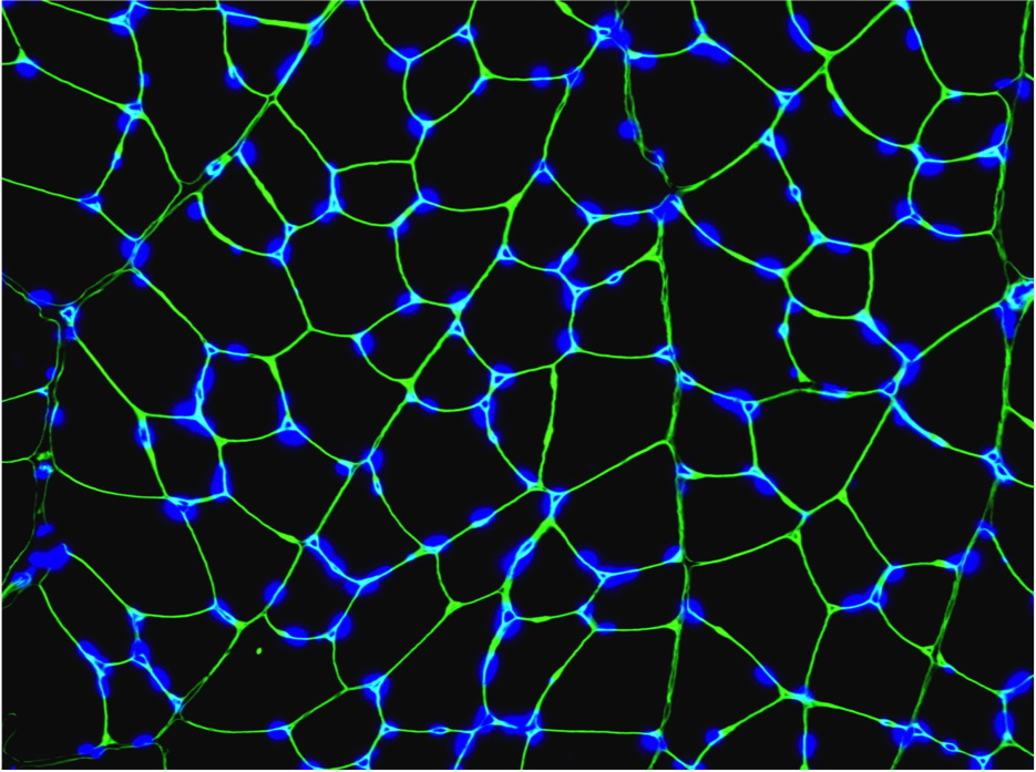 図１　骨格筋の顕微鏡画像